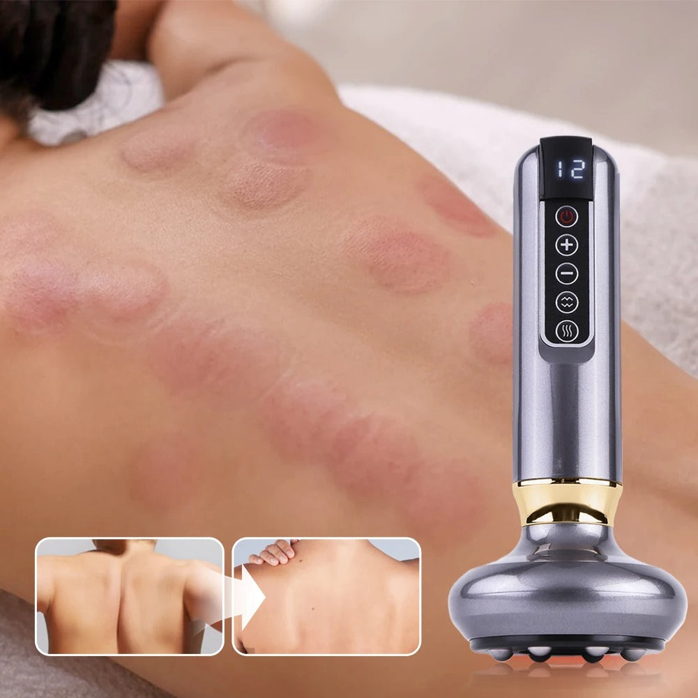 Cupping Massage Instrument