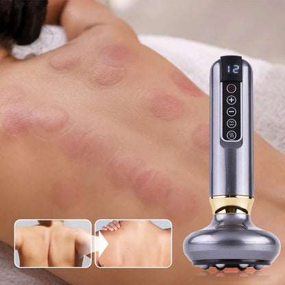 Cupping Massage Instrument
